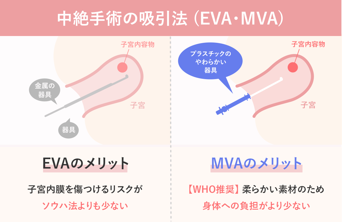 中絶手術の方法３種類（ソウハ法・吸引法EVA・吸引法MVA）